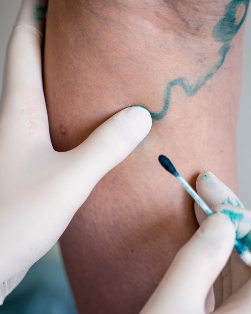 angiologia, chirurgia vascolare e ecodoppler